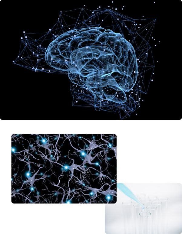 Image of Pathophysiology/Treatment R&D (Clinical, Basic)